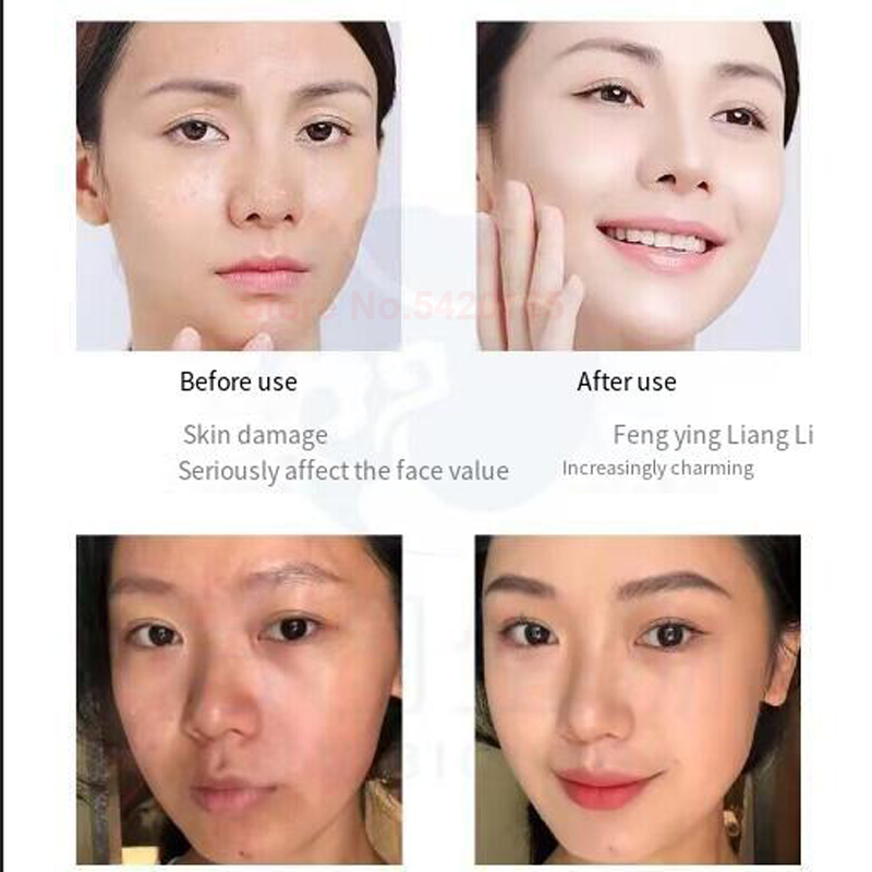 سيروم مسحوق الببتيد النحاسي ال - مراجعة Epidermal Growth Factor وسعره