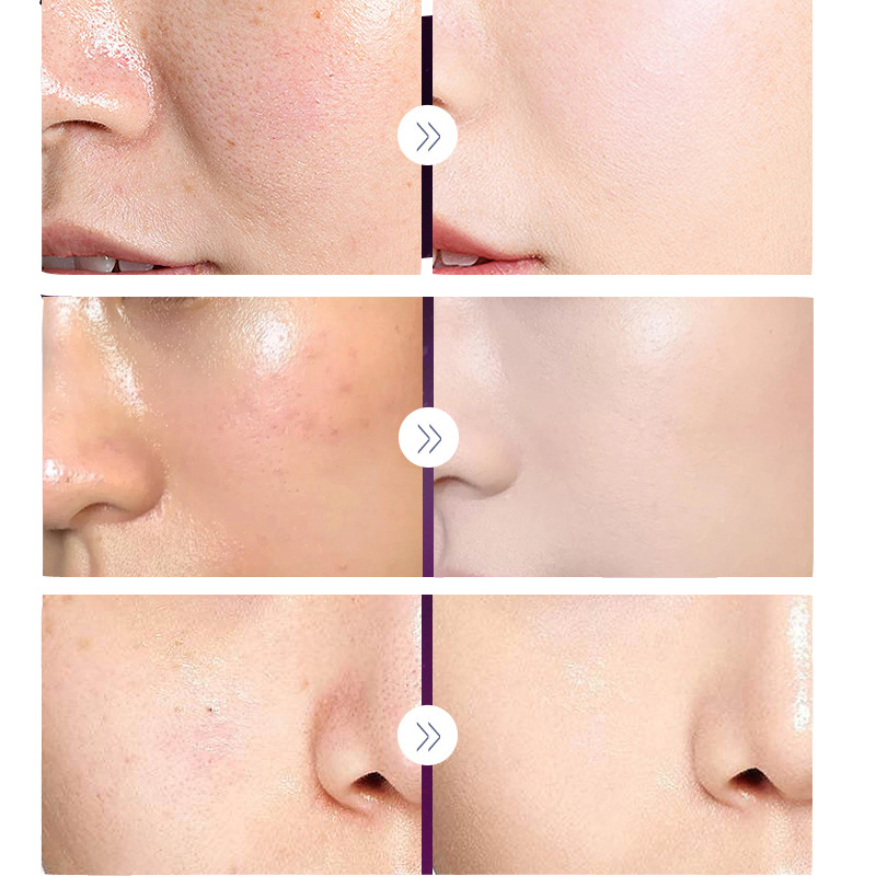 فاخر نوبل سيدة اللؤلؤ تبييض كر - مراجعة Luxury Skincare China وسعره