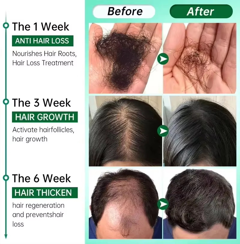 سيروم نمو الشعر، كبسولات أساسي - مراجعة Epidermal Growth Factor وسعره